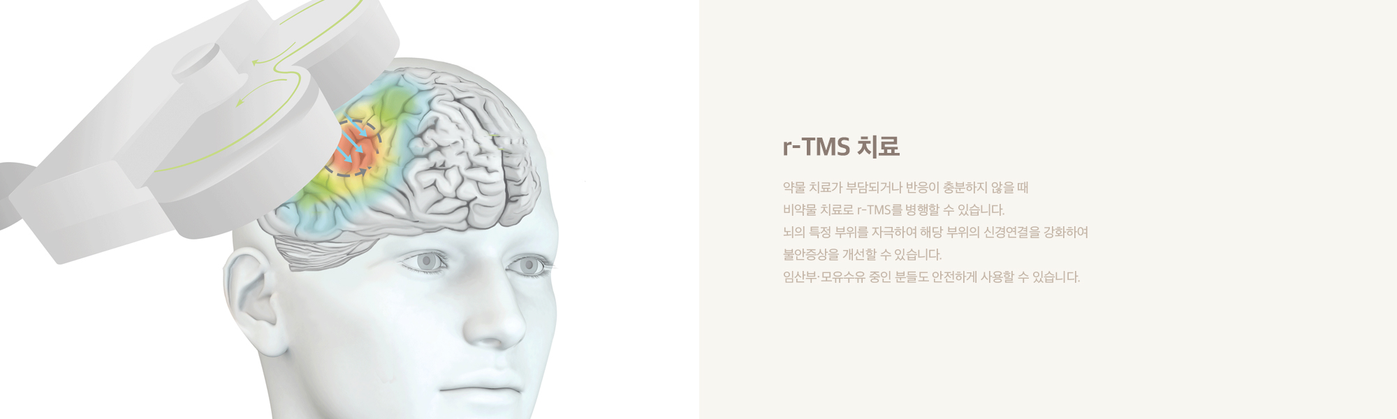 r-TMS 치료