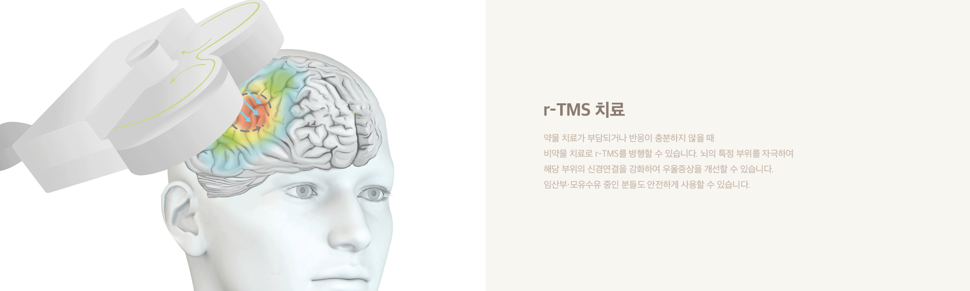 r-TMS 치료
