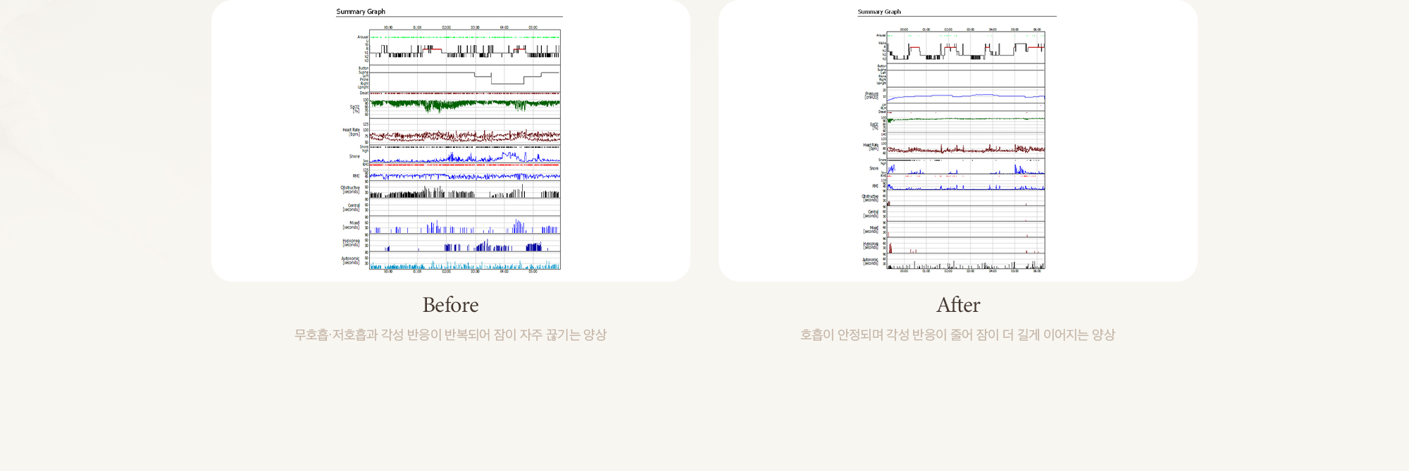 Summary Graph