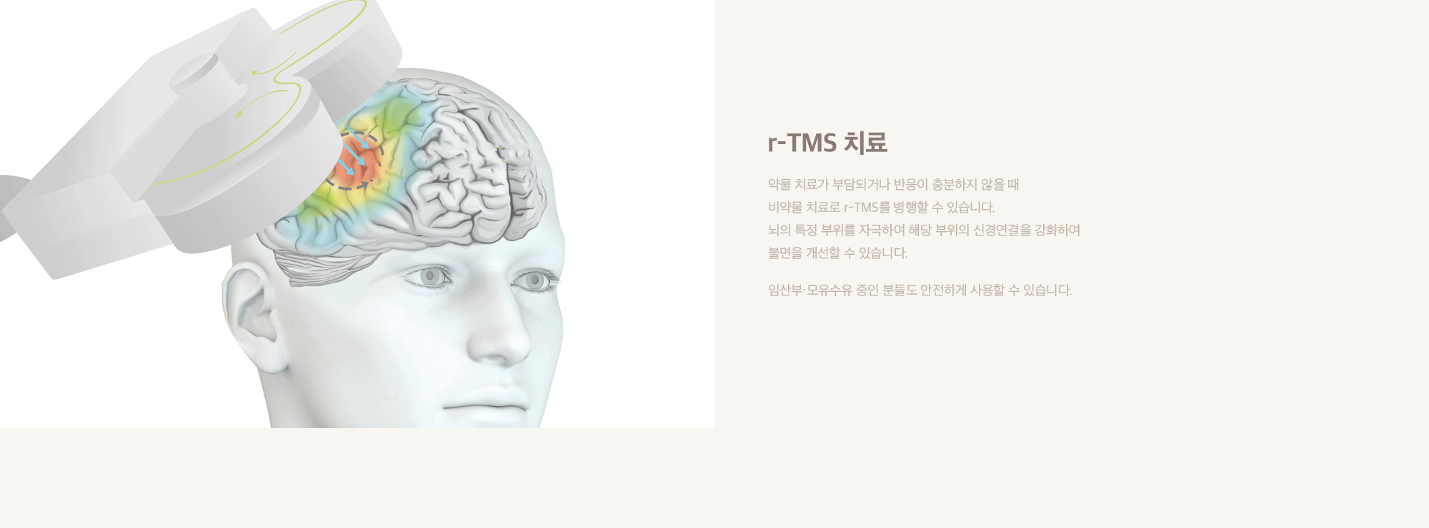r-TMS 치료